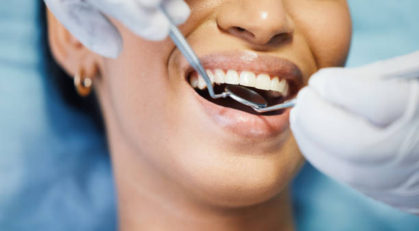 Best Emergency Dental Care for Broken or Chipped Teeth in Northford, CT